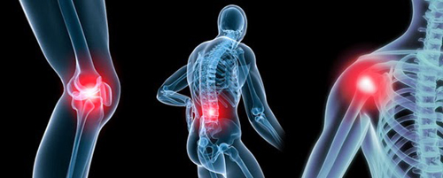 Phương pháp tự nhiên điều trị đau xương và khớp