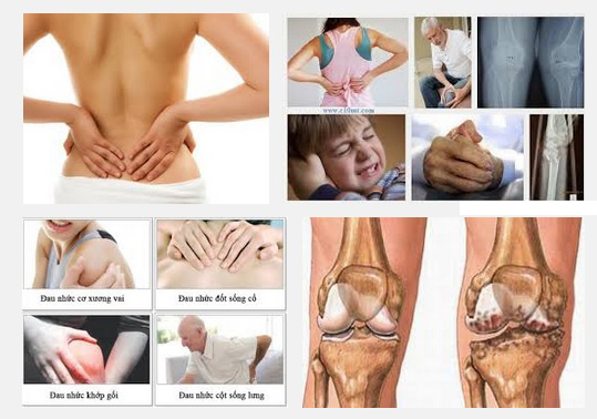 Cách điều trị đau cơ tại nhà
