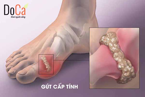 Ảnh hưởng đến tim mạch, hô hấp, xương khớp