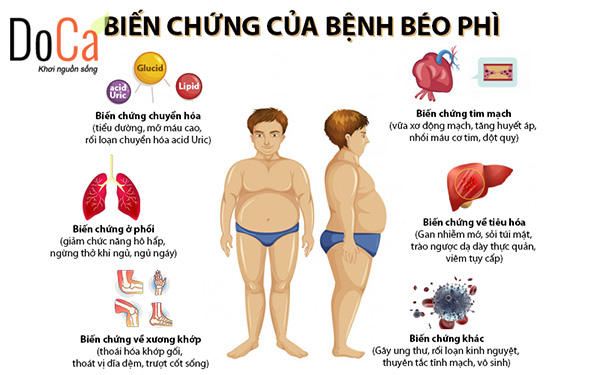 Bệnh béo phí nguy hiểm như thế nào?